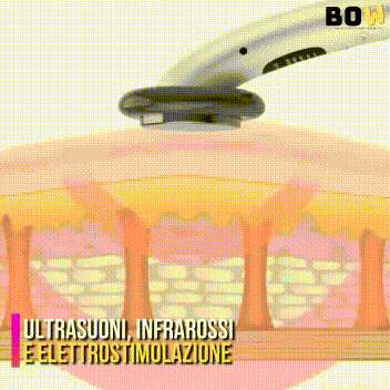 animazione effetto ultrasuoni sulla cellulite